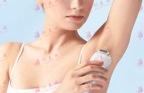 激光脱毛