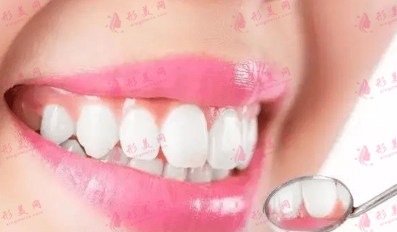 牙齿矫正的优缺点|在什么情况下必须做牙齿矫正？