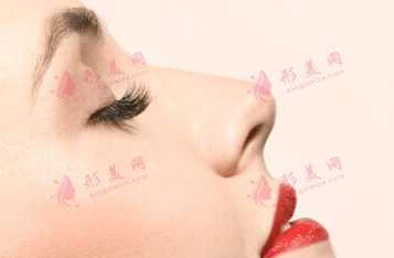 假体隆鼻会导致鼻炎吗？
