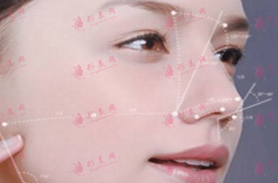 鼻子不满意的话该怎么修复？