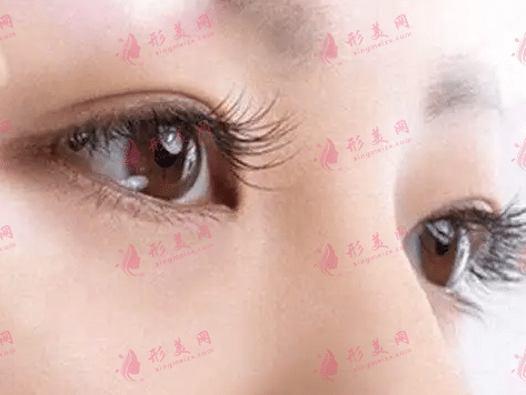 上海九院哪个医生做双眼皮和双眼皮修复比较好？