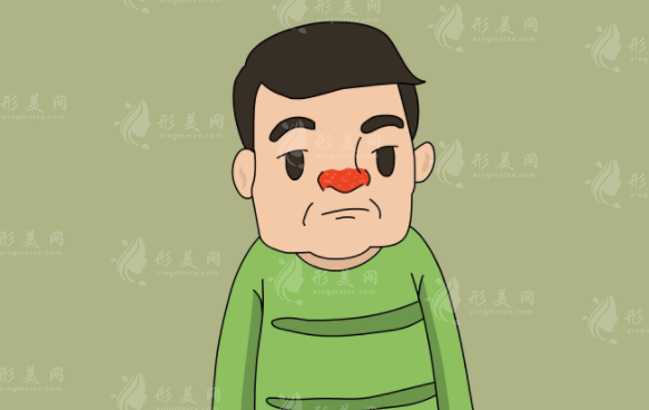 酒糟鼻可以根治吗？下面将从以下几个方面进行探讨