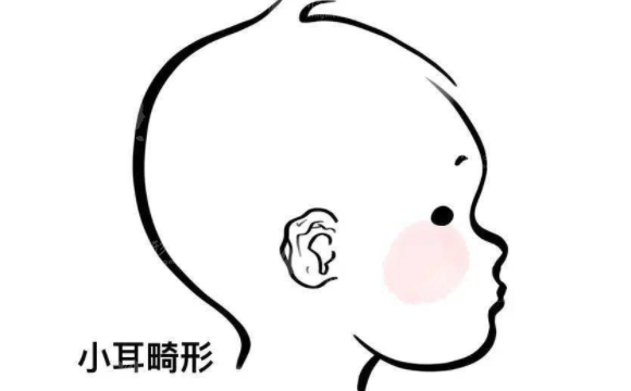 小耳畸形矫正的佳年龄是多少？术后会影响听力吗？