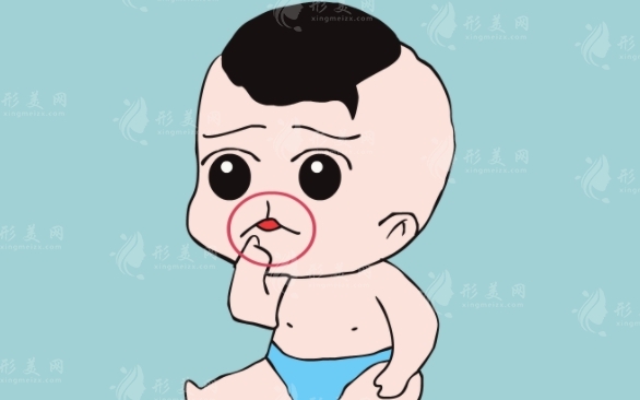 兔唇手术费用解析：价格高低与哪些因素有关？