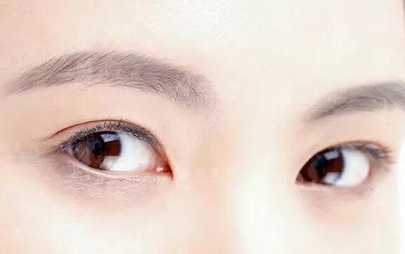 哪些因素会影响自体脂肪隆眉弓的恢复期