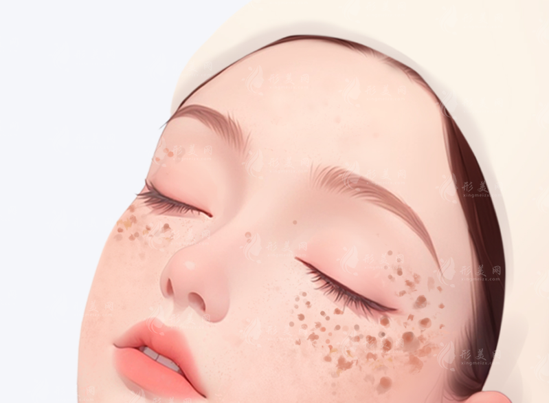 2026激光祛斑价格揭秘：几百到上万差别在哪