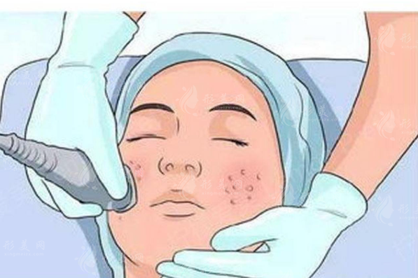 2026激光祛斑价格揭秘：几百到上万差别在哪