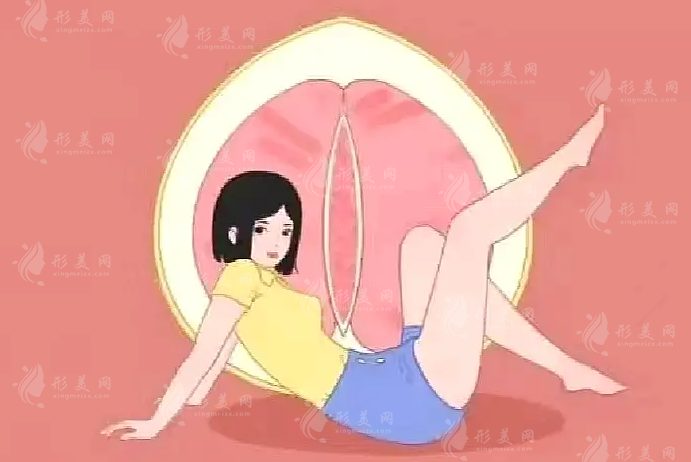 小阴唇整形选哪种形状好？蝴蝶型水滴型柳叶型效果对比