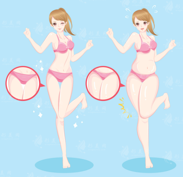 北京吸脂修复价格揭秘：前十医院医生+避坑指南