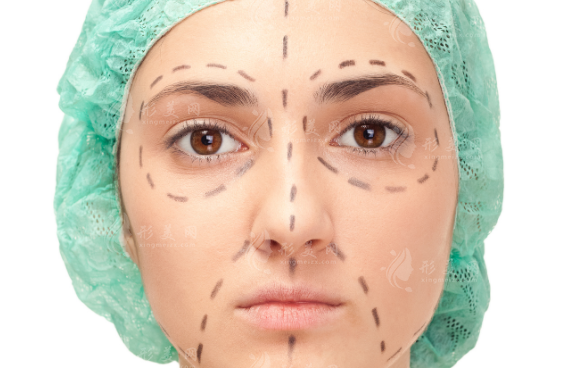 双矢量青春定格术好不好?小切口实现3-5年面部提升真相