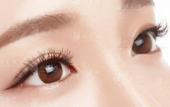 王小彦双眼皮2026价格表：埋线/切开/修复多少钱