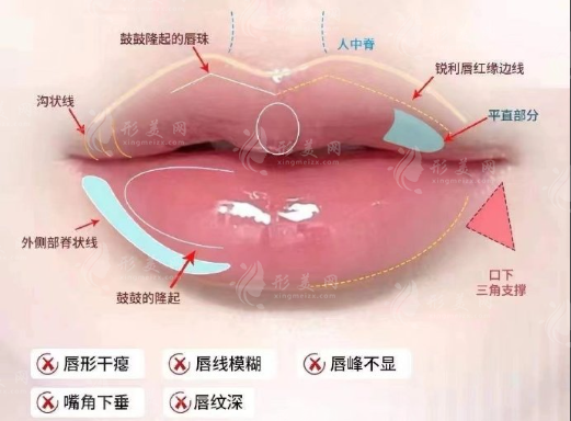哪些人适合用娇兰打嘟嘟唇？