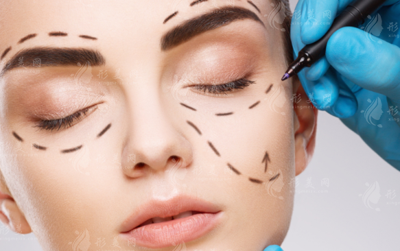 北京薇拉整形医院靠谱吗?2026全新价格表+医生项目全揭秘