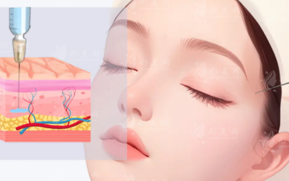 乔雅登丰颜vs塑颜：区别在哪怎么选?一看就懂!