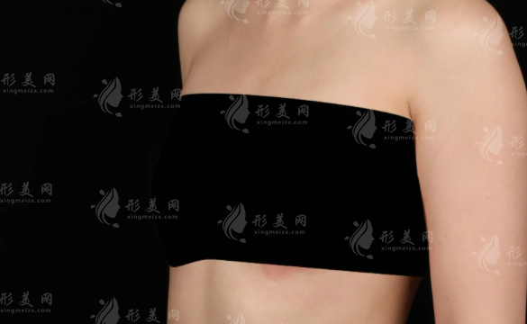 西安隆胸医生排名出炉!这4位技术真叫绝了