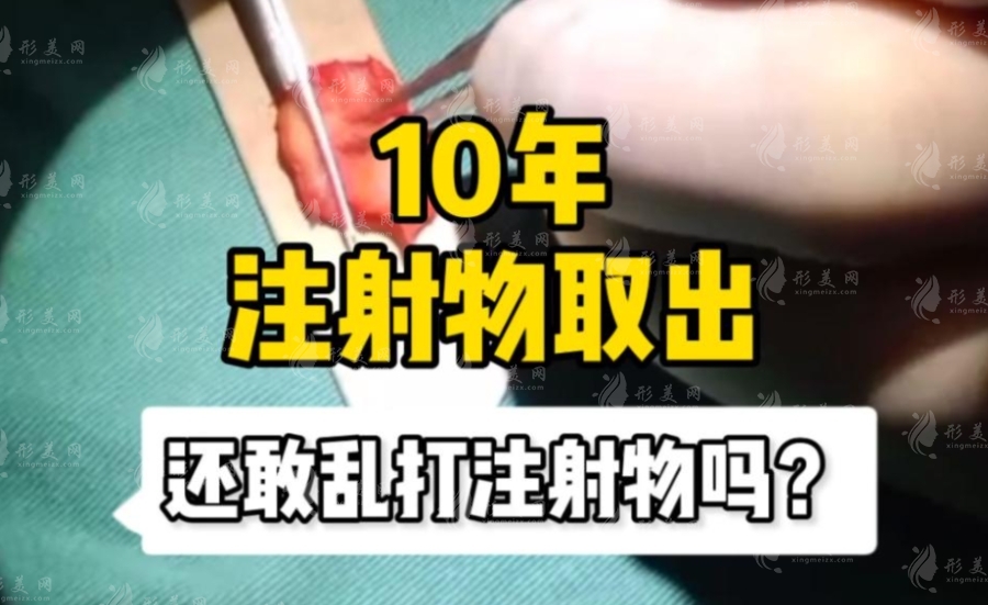 北京注射物取出医生推荐：郭鑫医生技术好口碑佳