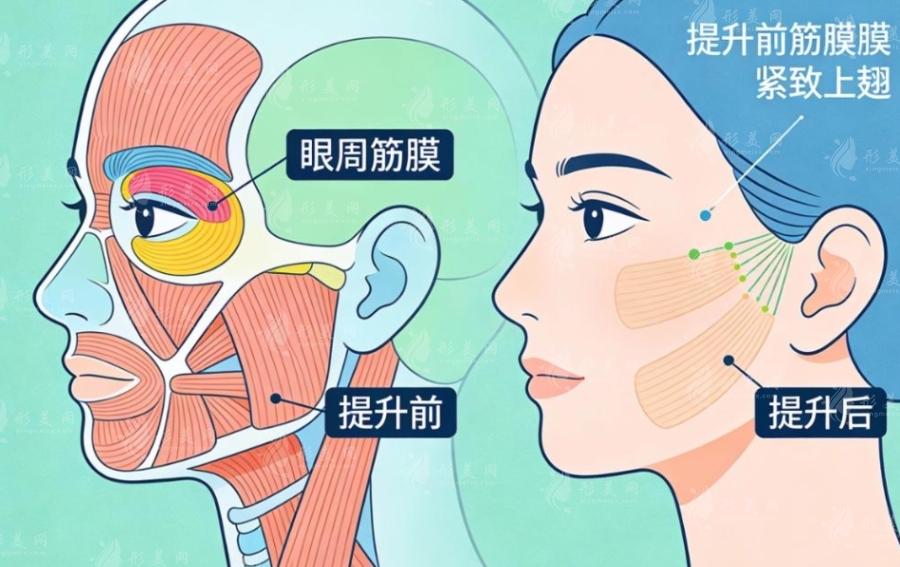 2026北京无痕筋膜提升价格全曝光！多少钱才合理