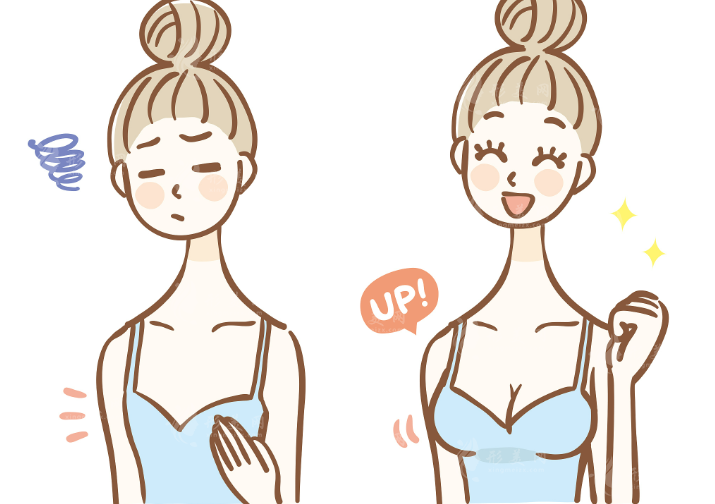 成都张雪峰医生隆胸怎么样？米兰柏羽2026技术实测