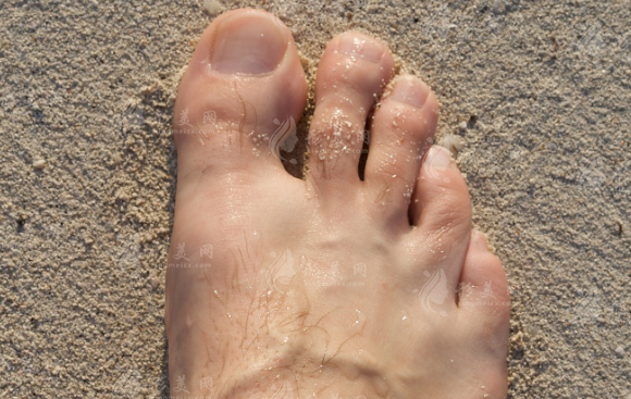 苏敬达脚趾缩短不踩坑?微创技术7天下地