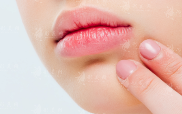 2026唇部整形医院排名前十!口碑医生+实价清单全公开