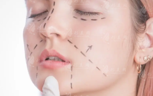 成都无痕筋膜术哪家好?5家正规医院医生推荐