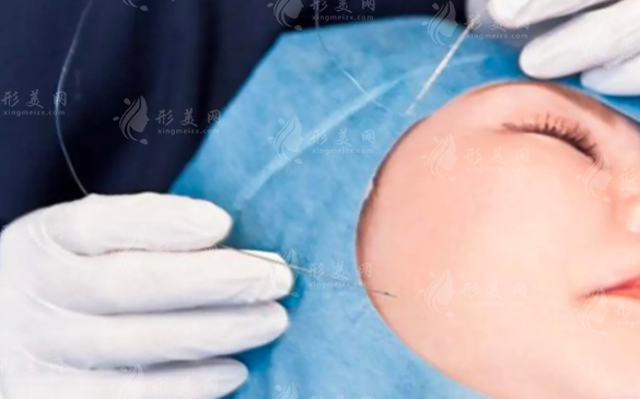 小切口筋膜悬吊术医院排名!这10位医生技术绝了