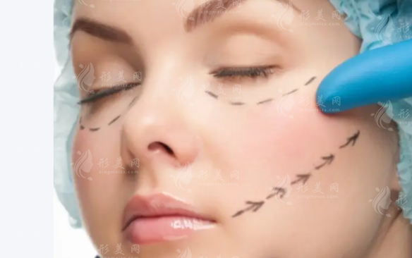 深圳无痕筋膜提升费用揭秘：3万起到底值不值？