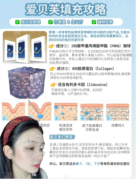 爱贝芙注射部位全图解：鼻子下巴法令纹剂量价格一览
