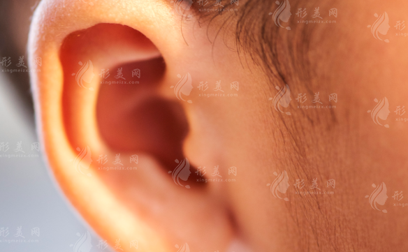 郑州张正文耳再造技术靠谱吗?5万起重塑真耳朵
