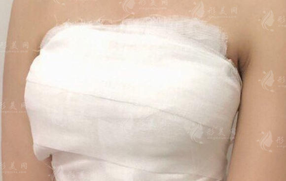 自体脂肪填充胸部臀部能一起做吗?专家详解