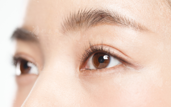 2026双眼皮修复医生排行榜揭晓!刘志刚、杜园园、魏志香稳居眼修复前三