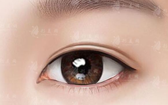 武汉眼修复选王海平还是项利姣?20年+医生技术流派大PK 武汉眼修复选王海平还是项利姣?20年+医生技术流派大PK