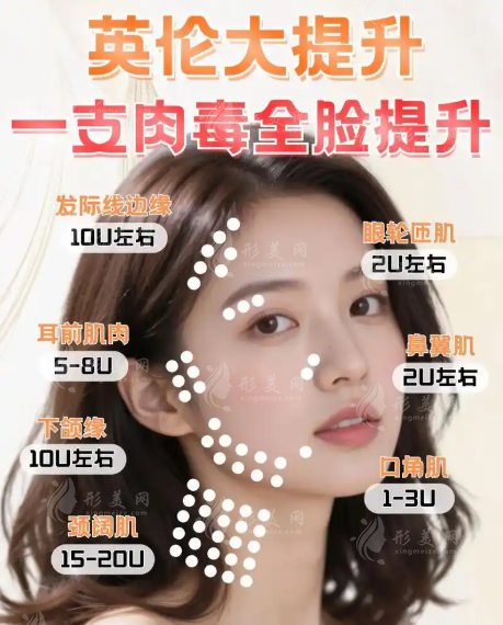 武汉艺星英伦大提升效果好吗?朱胜军医生技术价格全揭秘 武汉艺星英伦大提升效果好吗?朱胜军医生技术价格全揭秘