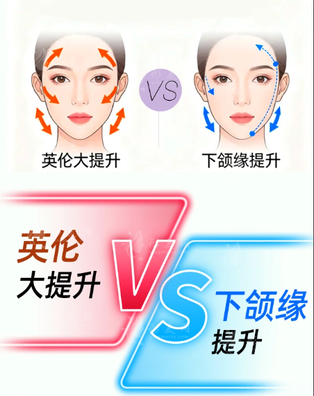 武汉艺星英伦大提升效果好吗?朱胜军医生技术价格全揭秘 武汉艺星英伦大提升效果好吗?朱胜军医生技术价格全揭秘