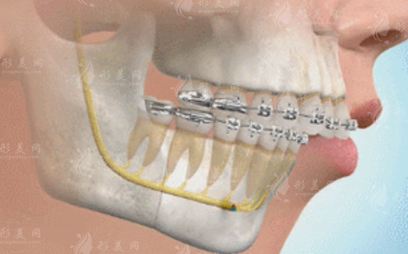肖林李继华罗恩磨骨谁厉害?下颌角颧骨整形医生对比测评