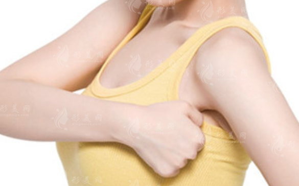 梦萦假体怎么选?4种凸度77种尺寸全攻略!