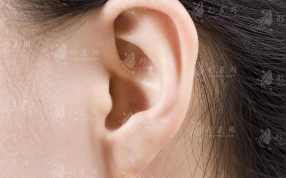 2026耳再造医生排名出炉!这4位专家实力霸榜