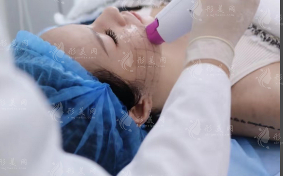 2026热玛吉官方授权医院名单!12城认证医生汇总