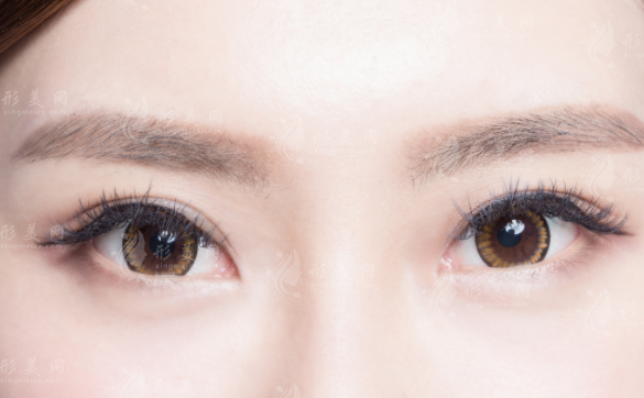 北京双眼皮修复医生排名：张冰洁/魏志香/师丽丽价格技术全解析