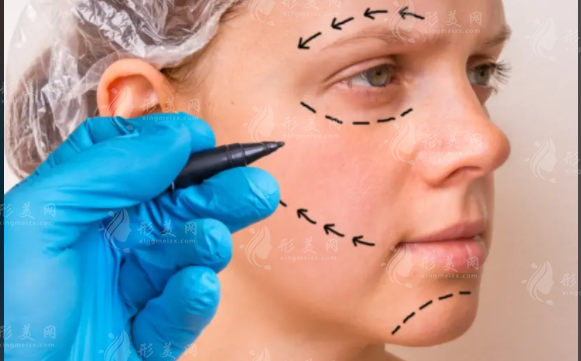 北京蒂凡妮筋膜提升靠谱吗?王志坚医生亲诊，微创抗衰新选择!