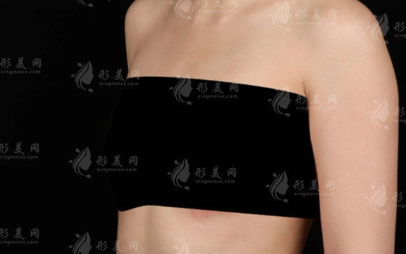 乳房再造哪里技术好？2026国内权威医院排名前十推荐