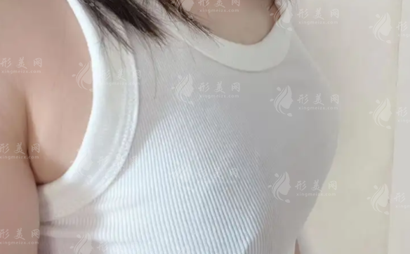 幸蕴无痕丰胸靠谱吗？效果/价格/维持时间全解析