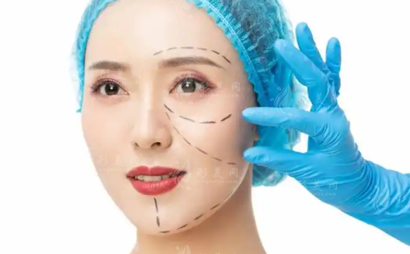 妮凯丽胶原蛋白多少钱一支?1500-5000元中高端III型胶原，填充抗衰双在线