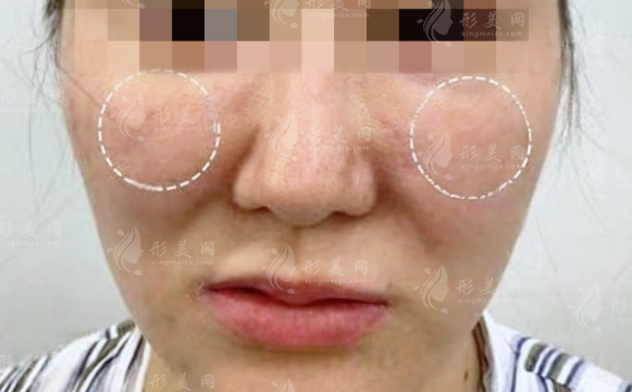 王绍国取生长因子多少钱?价格贵吗?和郭鑫谁技术更厉害?