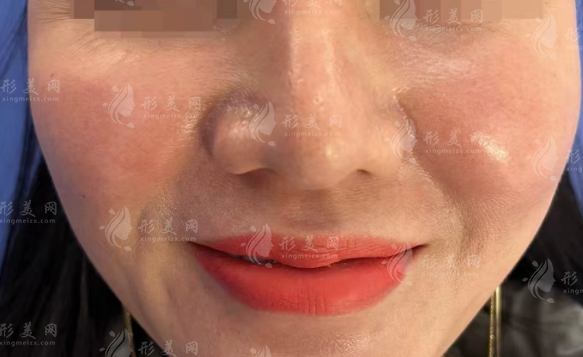 张立彬取生长因子技术好吗?坐诊医院 / 价格 / 优势全解析