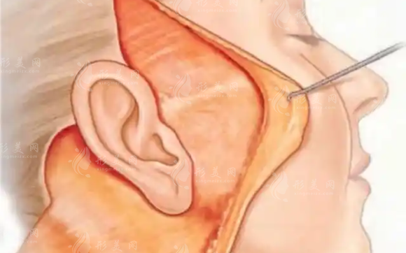 北京拉皮手术医生排名2026:穆宝安/袁强/李晓东/黄寅守坐诊医院揭晓 北京拉皮手术医生排名2026:穆宝安/袁强/李晓东/黄寅守坐诊医院揭晓