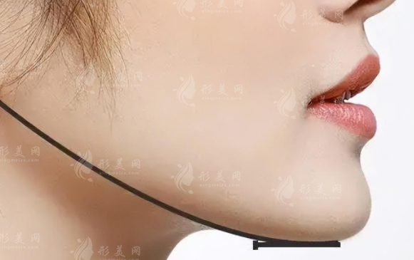 2026磨骨多少钱?北上广等7城价格+靠谱医生名单曝光