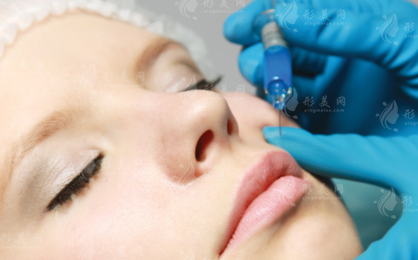 昆明玻尿酸注射哪家好?艺星铜雀台吴氏嘉美价格技术对比