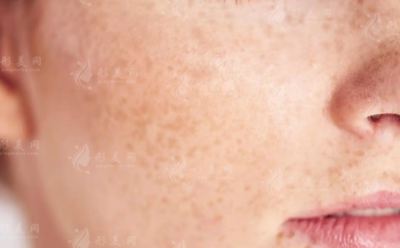 上海皮肤病医院哪家好?江城皮肤医院口碑实力全解析