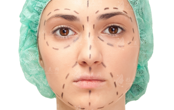 上海星璨李海涛拉皮靠谱吗?筋膜复位技术口碑实测